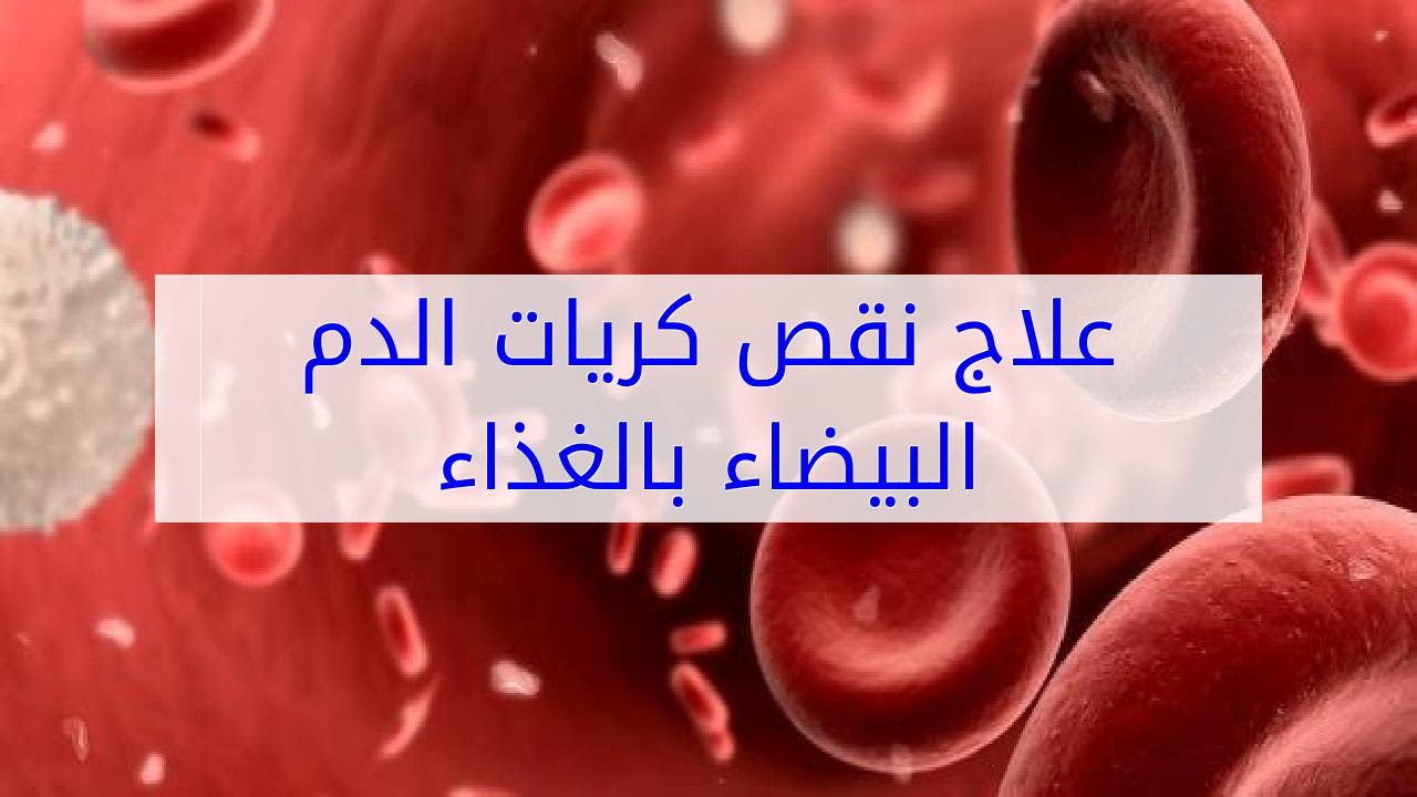 علاج نقص كريات الدم البيضاء - اعراض والتخلص من نقص الكرات البيضاء فى الدم 2265 2