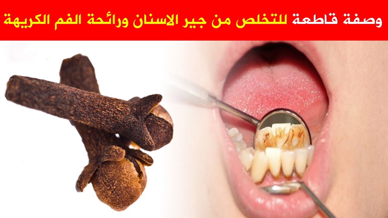 كيفية القضاء على رائحة الفم الكريهة- تخلصي من رائحه الفم الكريهه بابسط الطرق 6569 3