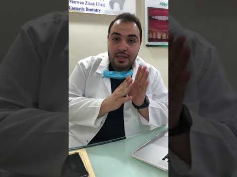 علاج خراج الضرس - طرق لعلاج خراج الاسنان والضروس 0 32