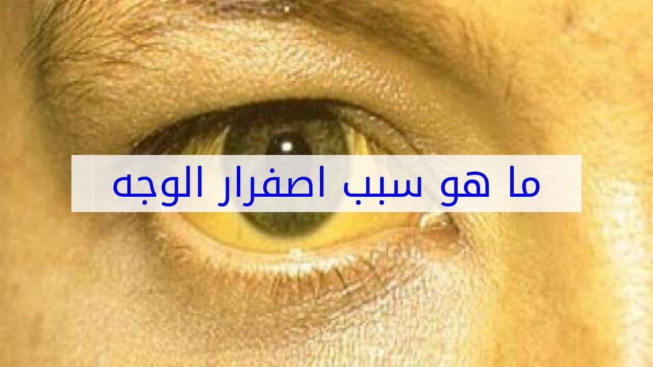 سبب صفار الوجه - علامات تغير الوان البشره الي الاصفر 5448 3