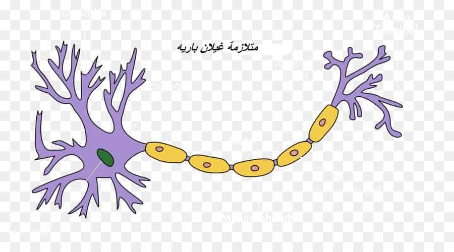 علاج متلازمة غيلان باريه بالاعشاب