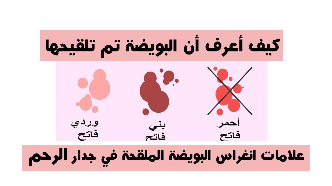 ماهو الحمل الكاذب- اهم الاعراض للحمل الكاذب 6576 1