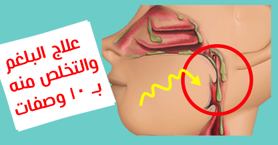 كيف اتخلص من البلغم , عايز تخلص من البلغم