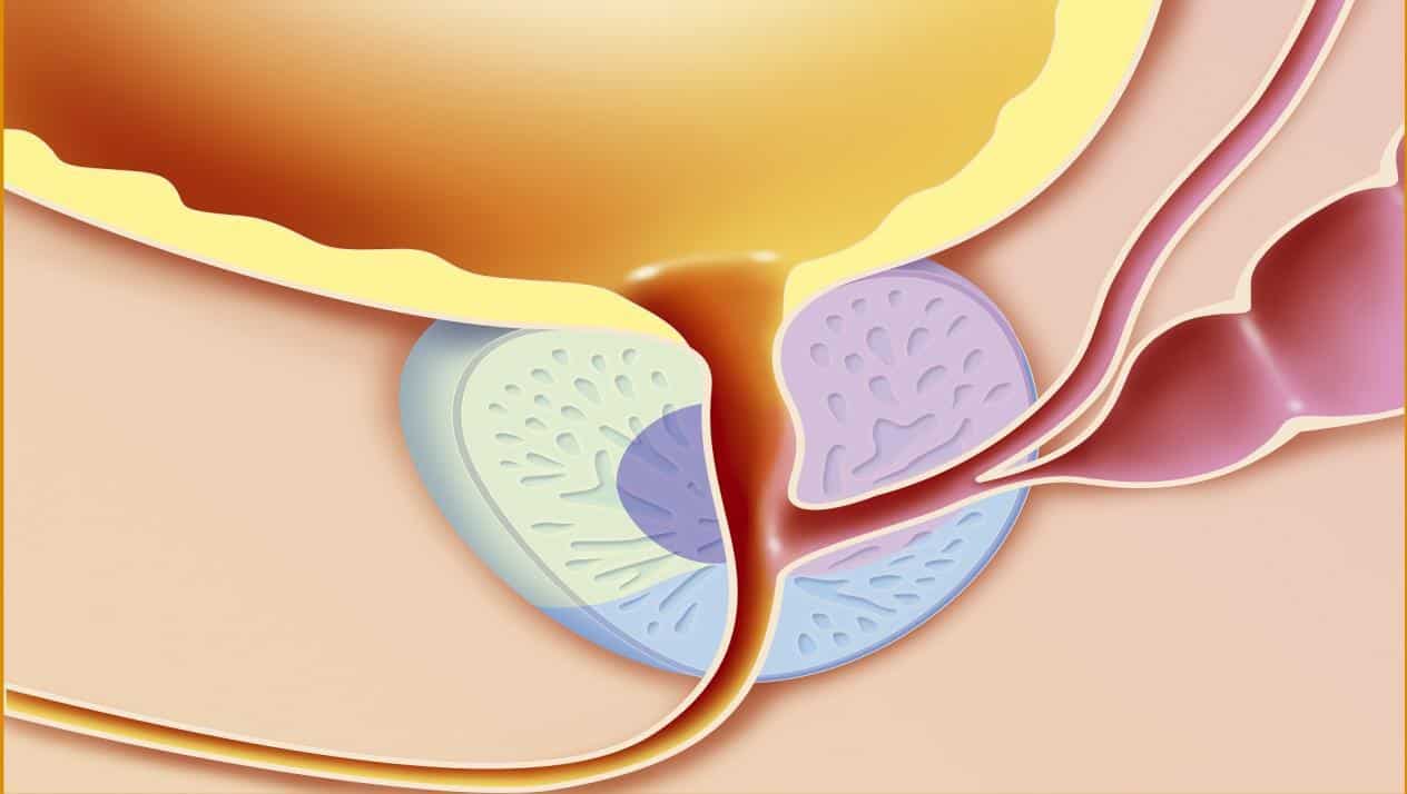 اعراض التهاب البروستاتا للشباب - ما هي غدة البروستاتا وكفية تجنب التهابها 3462 2