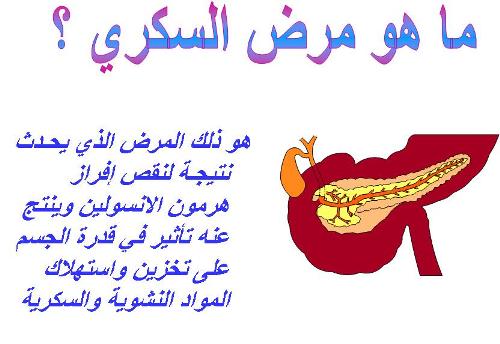 ما اسباب مرض السكر , الوقاية والعلاج