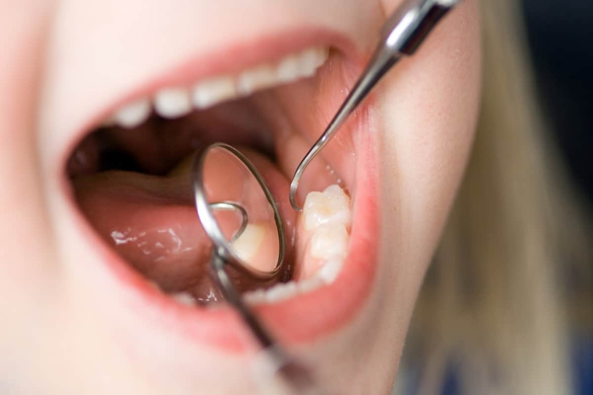 الاسنان الشفاء الضرس بالقران بالمصحف طرق علاج
