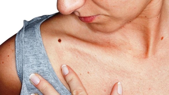 اعراض التهاب الثدي الغدد الليمفاوية الليمفاويه تعالجها تعرف في كيف ملتهبه وكيف