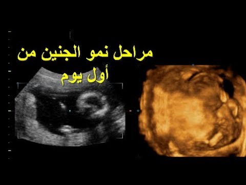 الجنين الطبيعي النمو اول بالصور تكوين للطفل مراحل من يوم