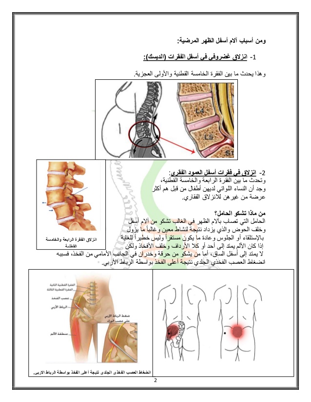 الام الظهر اثناء الحمل - اسباب وعلاج الالم 5528 3