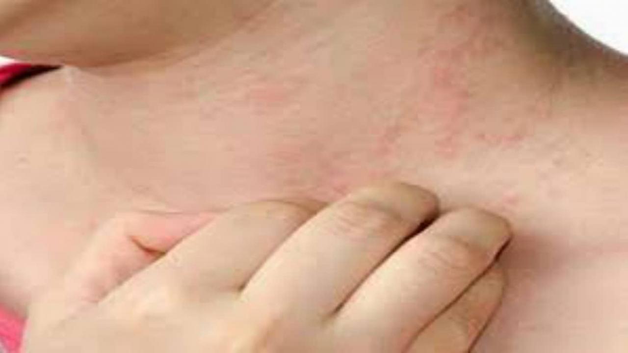 اسباب الجلد المزعجة حساسية حكة علاج