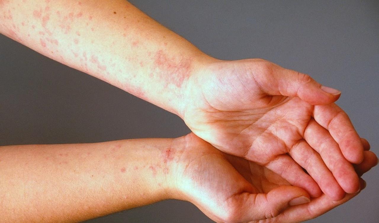 اسباب الجلد المزعجة حساسية حكة علاج