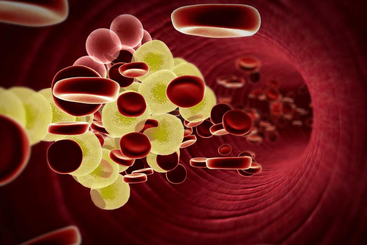 Cholesterol اختبار ارتفاعه الدم تحليل دهون علاج هو وطرق