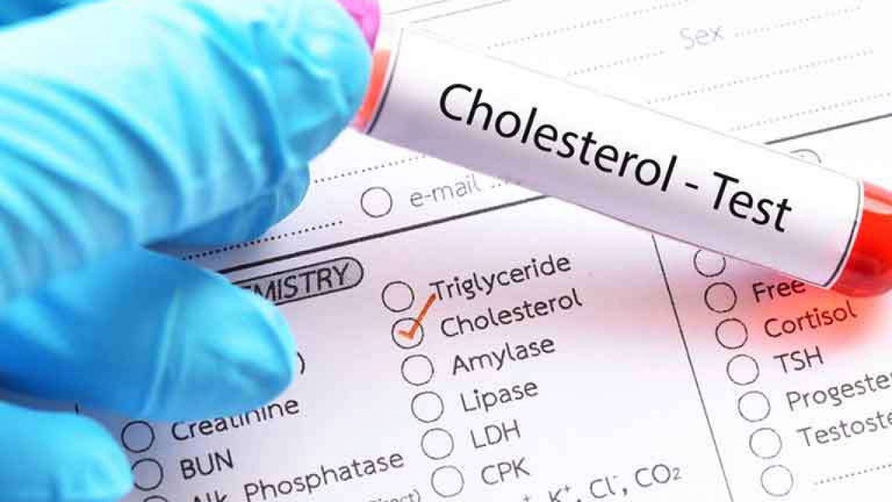 Cholesterol اختبار ارتفاعه الدم تحليل دهون علاج هو وطرق