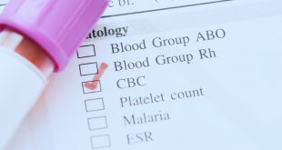 اعرف الدم السرطان الشامل اني تحليل سرطان عندي ممكن من هل يكشف